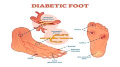 Diabetik ayaq mərkəzi